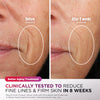 Shark™ CryoGlow™ Red Blue & Infrared iQLED Face Mask & Under Eye Cooling w/ Charging Stand (Lilac Chill)