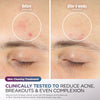 Shark™ CryoGlow™ Red Blue & Infrared iQLED Face Mask & Under Eye Cooling w/ Charging Stand (Lilac Chill)
